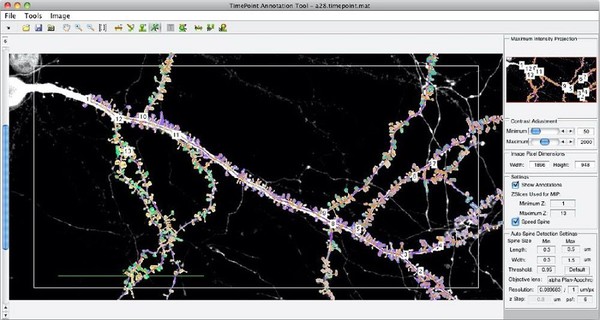 圖1 : 基於MATLAB的Spine Tool,用來將樹突棘的偵測、註記和分析自動化。