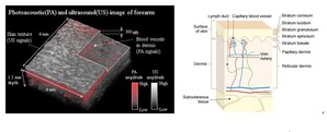愛德萬測試成功研發出高解析度的新3D成像技術,結合光聲與超音波成像技術取得真皮層的血管網路3D影像。