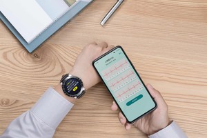 華碩VivoWatch智慧健康錶系列的ECG APP ,能夠建立、紀錄、儲存、傳送與顯示第一導程(Lead I)相似的單通道心電圖。