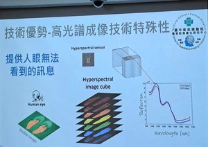 高光譜成像技術透過光的波長、能量及影像突破視覺限制,可在臨床上應用分析評估不同等級的風險及罹病機率。(source:台中榮總)
